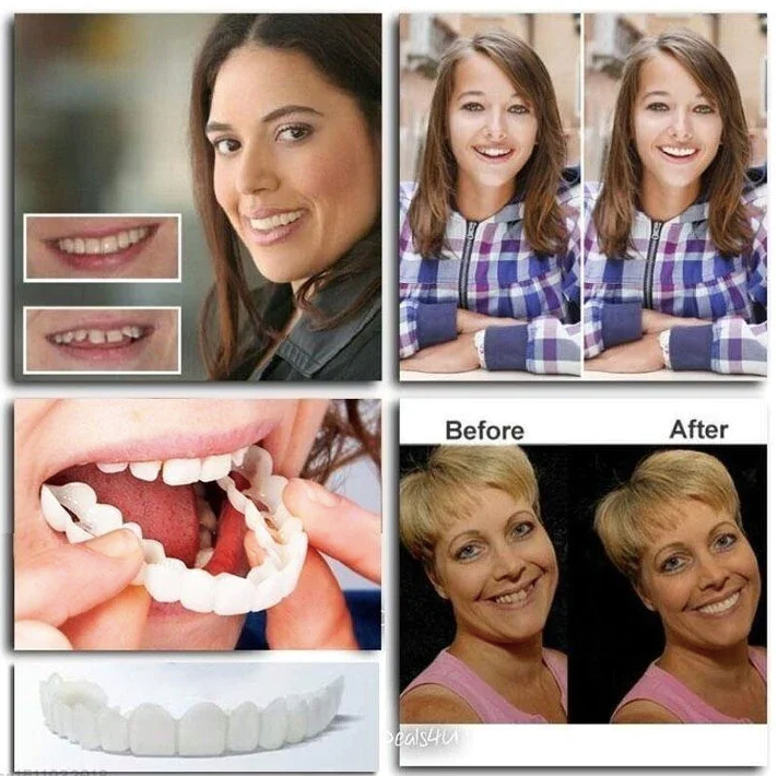 Perfect Smile™ Adjustable Snap-On Dentures (2023 Edition)